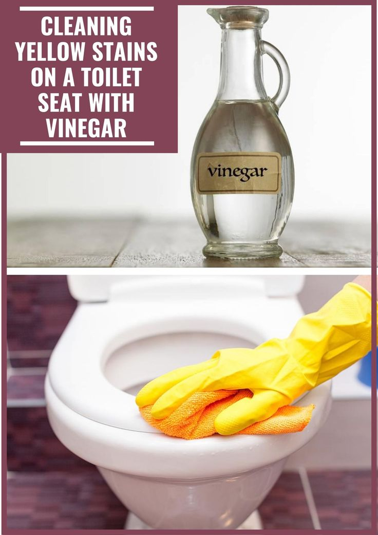 How To Get Yellow Stain From Toilet At Bradley Ford Blog inside Remove Toilet Bowl Stains